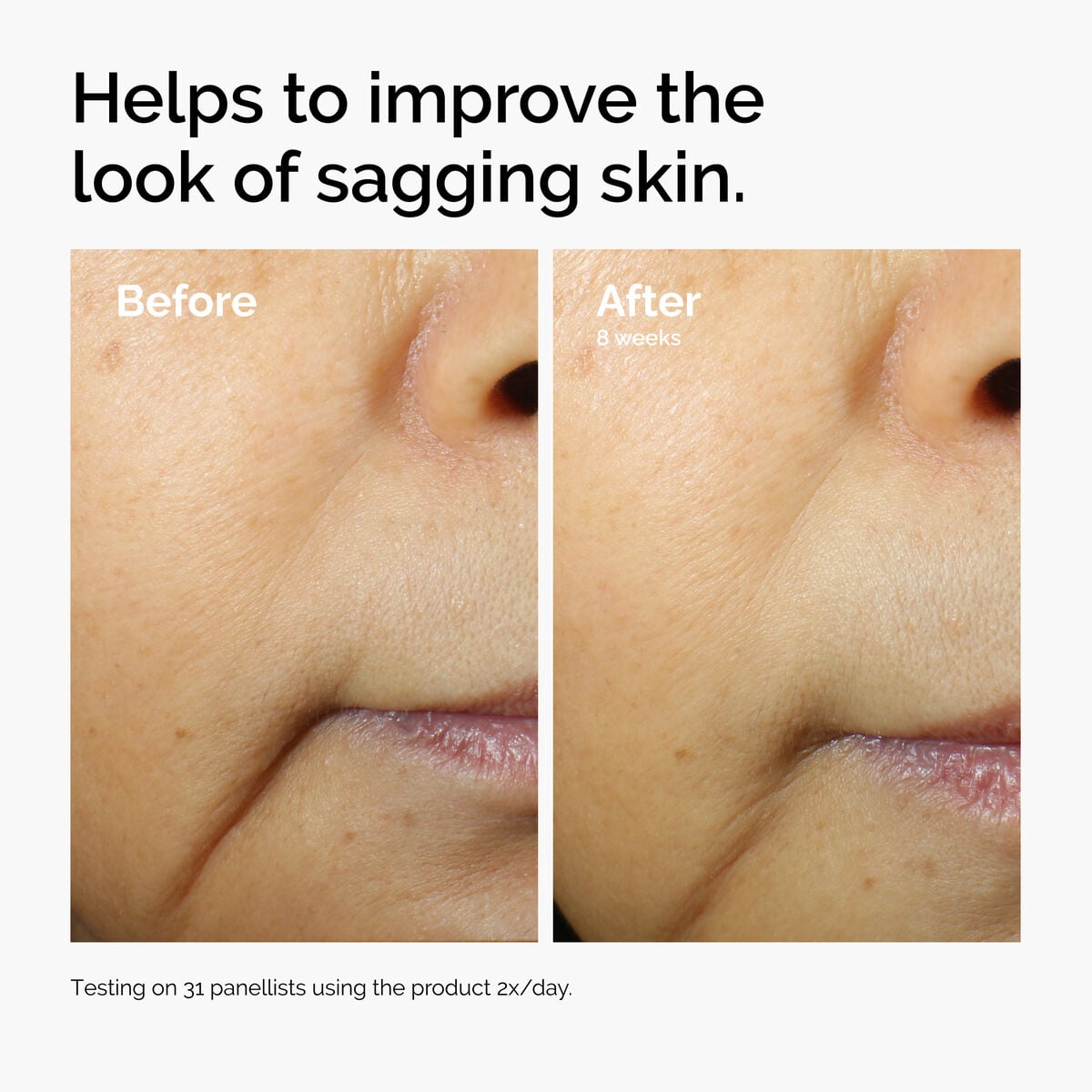 caffeine-3-escin-1-face-serum-c8 ord-caffeine-3pct-escin-1pct-face-serum-before-after-sagging.jpg