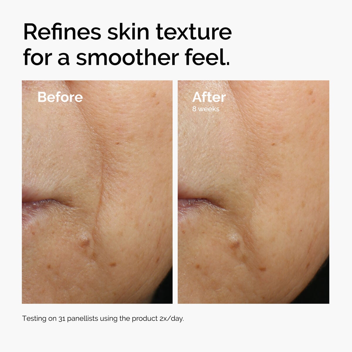 caffeine-3-escin-1-face-serum-c8 ord-caffeine-3pct-escin-1pct-face-serum-before-after-texture.jpg