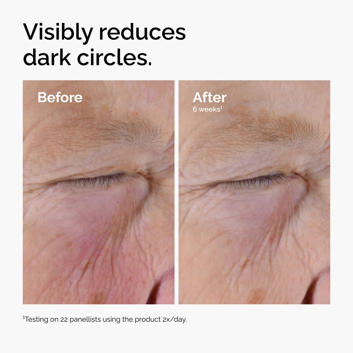 caffeine-solution-5-egcg-eye-serum-x9 ord-caffeine-solution-egcg-dark-circles-before-after.jpg