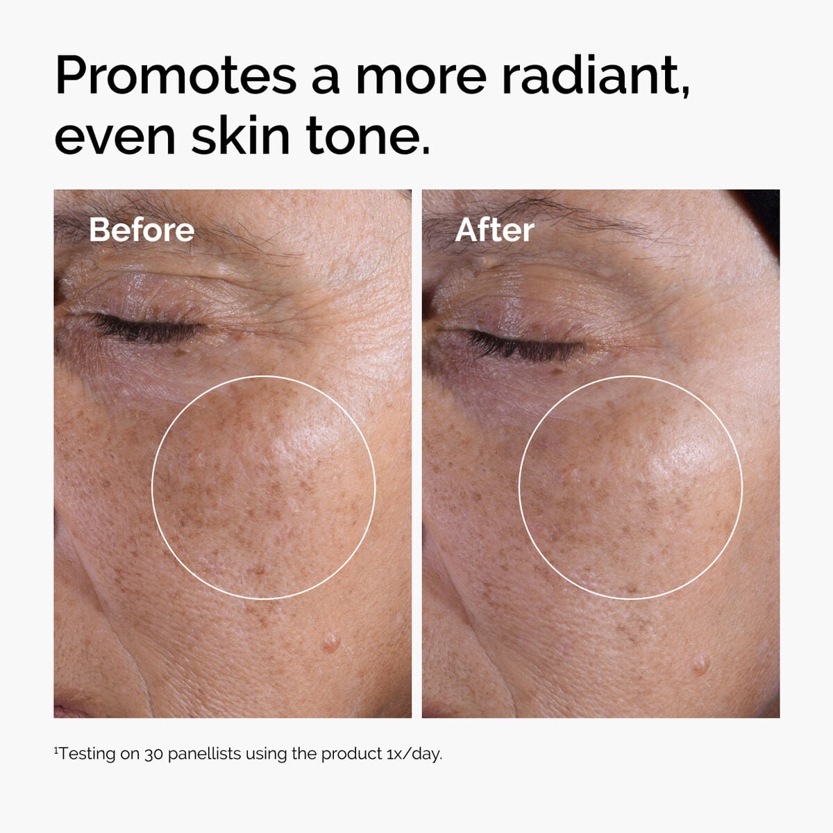 glycolic-acid-7-exfoliating-toner-e2 ord-glycolic-before-after-radiance.jpg