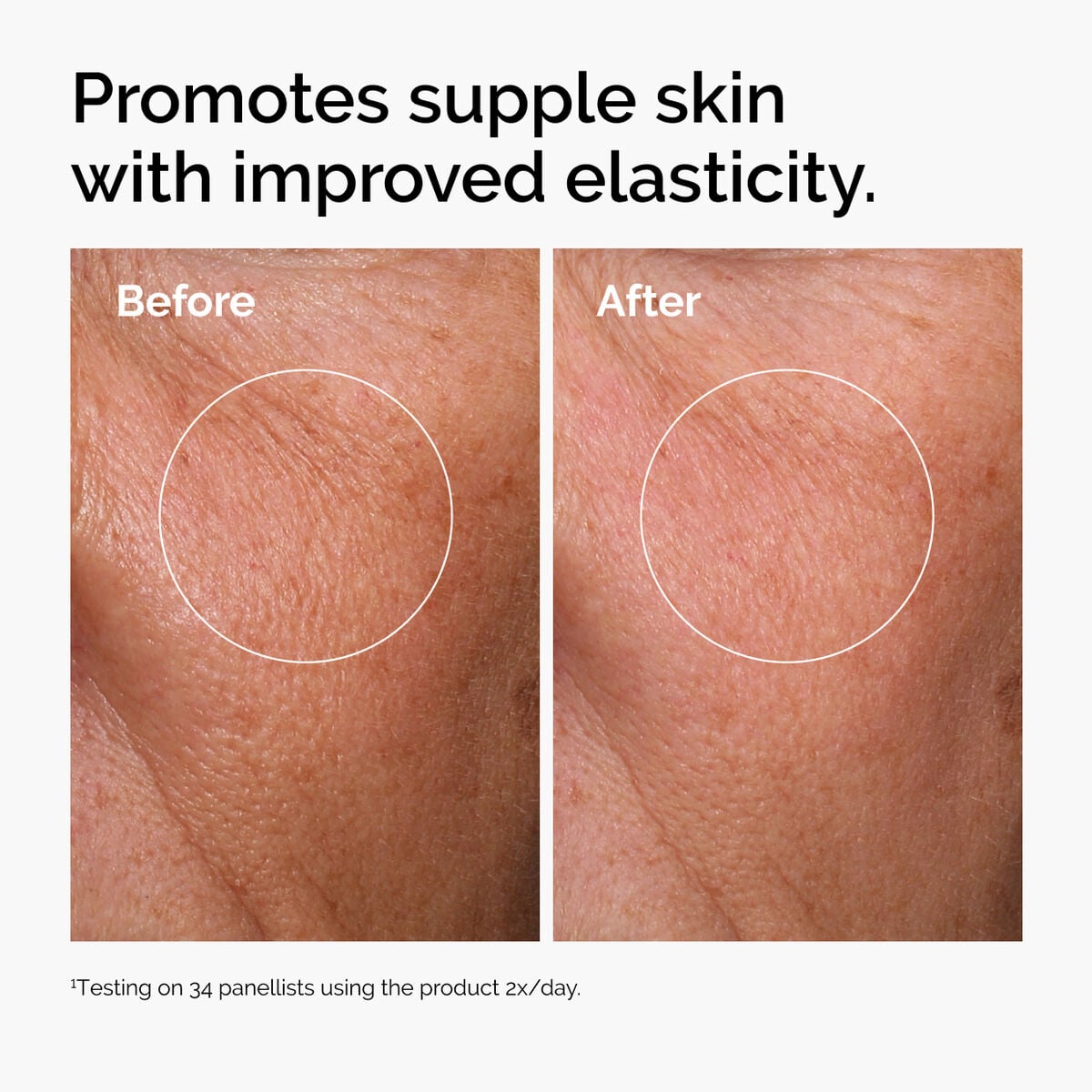 hyaluronic-acid-2-b5-with-ceramides-m8 ord-hyaluronic-acid-2pct-b5-hydrating-serum-before-after-elasticity.jpg