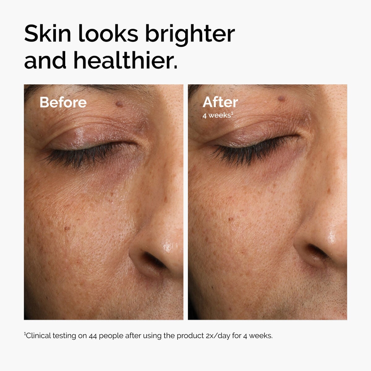 multi-antioxidant-radiance-serum-e1 ord-mars-before-after-healthy.jpg