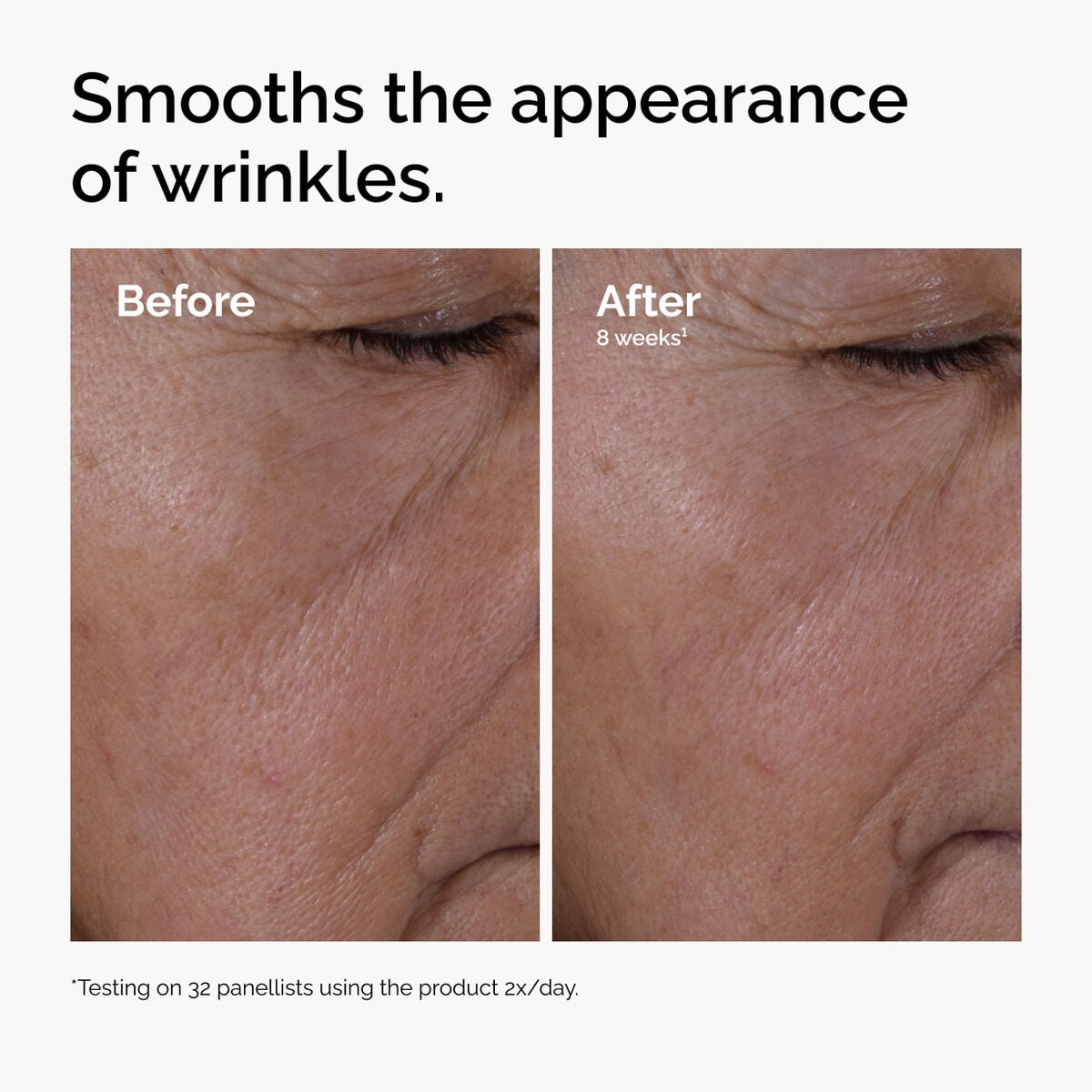 multi-peptide-ha-serum-u1 ord-multi-peptide-ha-serum-wrinkles-before-after.jpg