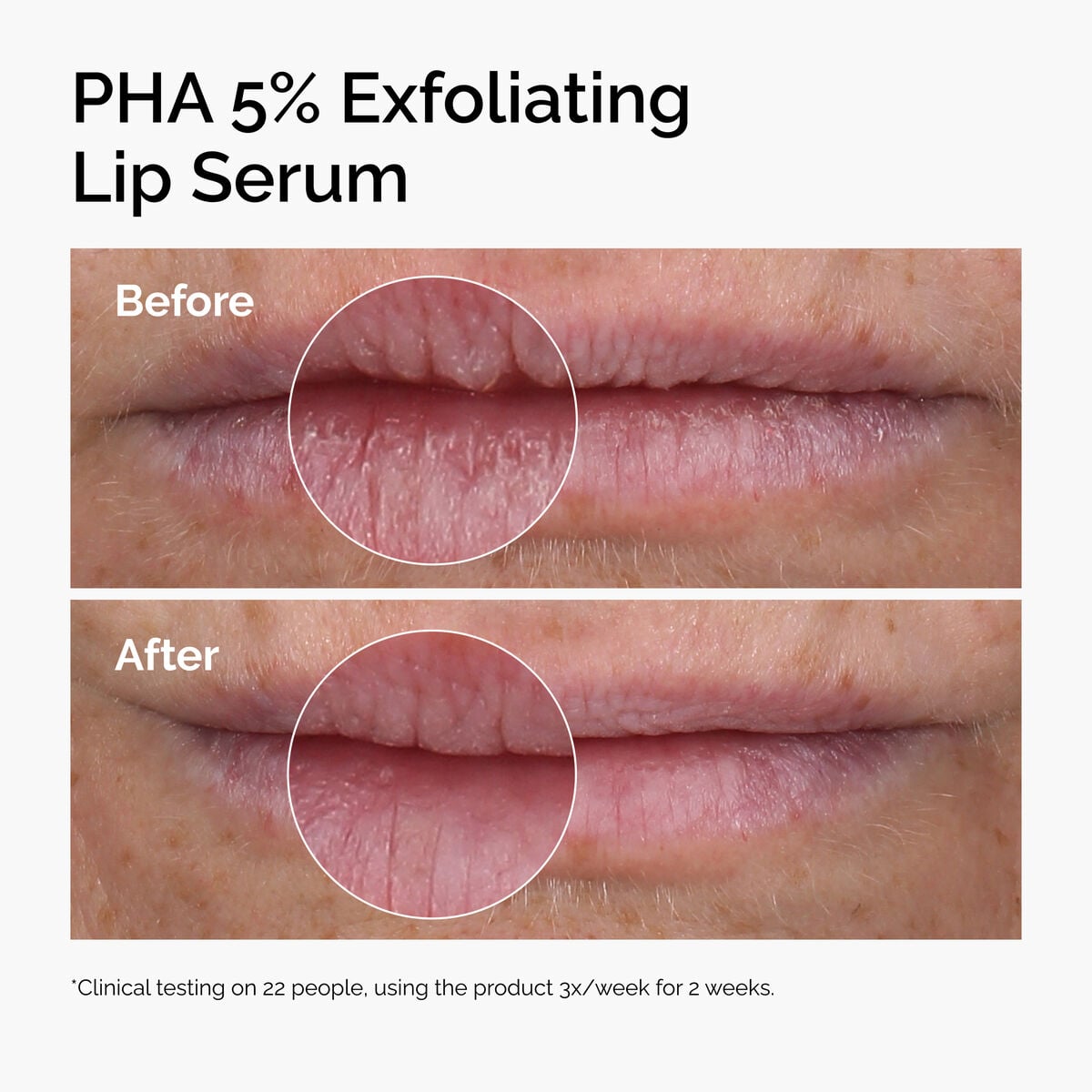 pha-5-exfoliating-lip-serum-r3 ord-pha-5pct-lip-exfoliating-serum-before-after.jpg