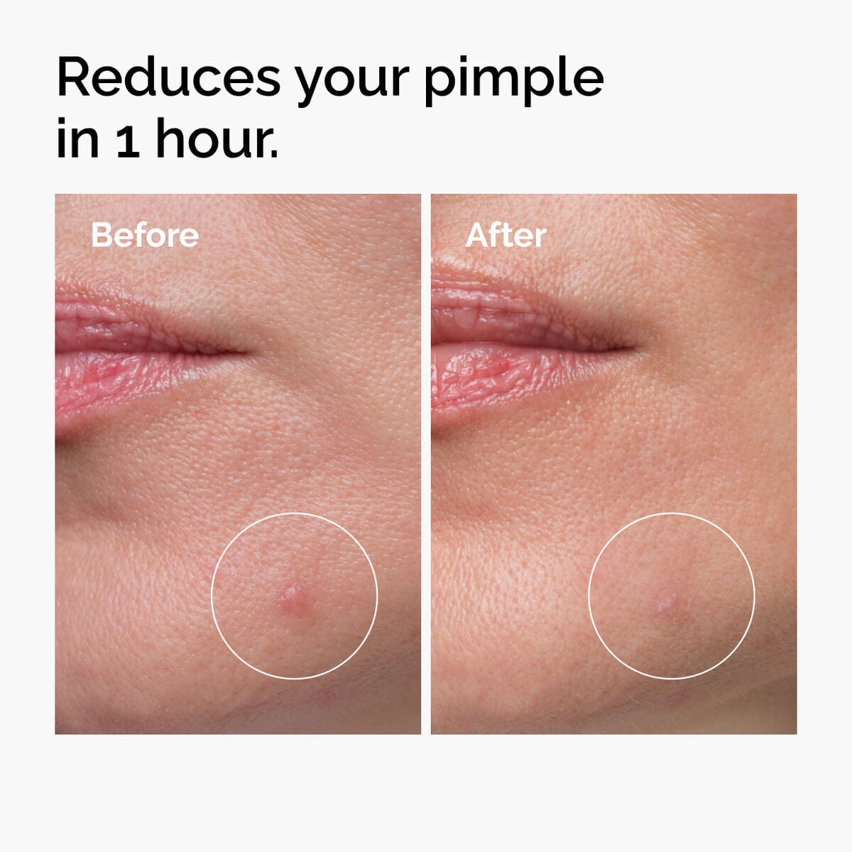 sulfur-10-powder-to-cream-concentrate-w8 ord-sulfur-10pct-powder-to-cream-concentrate-before-after-NA.jpg